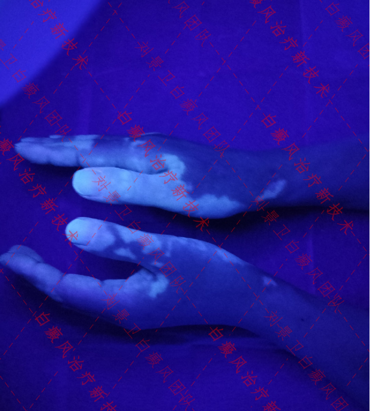 1637138317942930.png