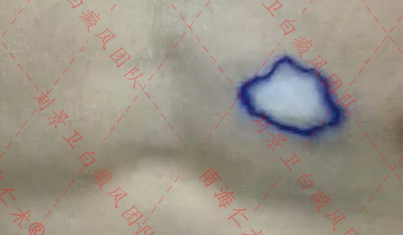 海口仁术皮肤.png