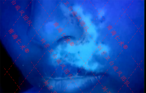 海口仁术皮肤治疗案例.png