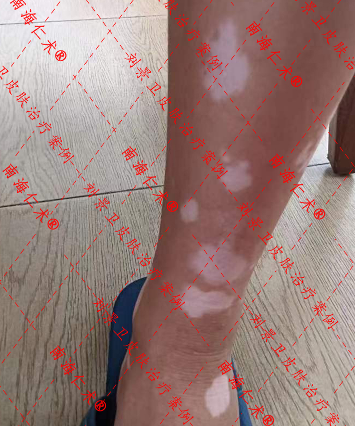 1703044428116667.jpg