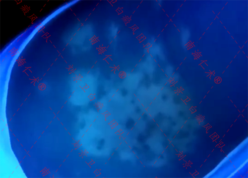 海口仁术白癜风.png