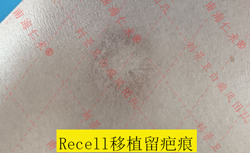 ee24490e5e0fe909df4b71a777bc89e2.jpg